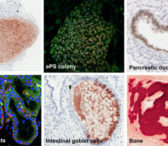 Smart-Bra Global Biologics Inc.