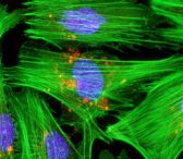 The Future of Cardio Therapeutics